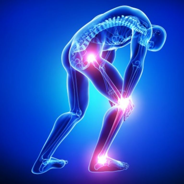 leg-injury-p-physio-exelixis-health-center